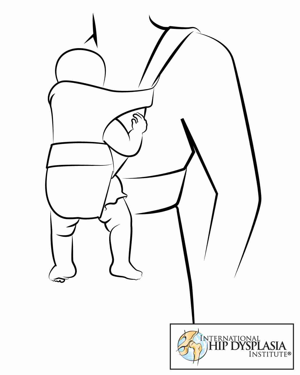 Dangling legs in baby carriers may contribute to hip dysplasia.