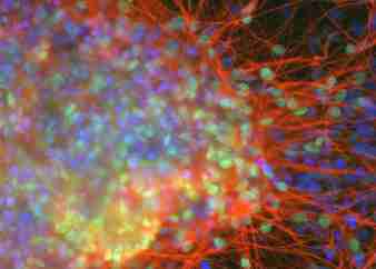 Photo of cortical neurons